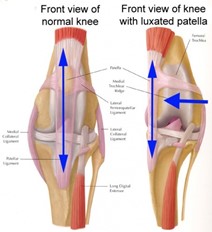 graphic of a normal view of a knee compared to a knee with a luxated patella